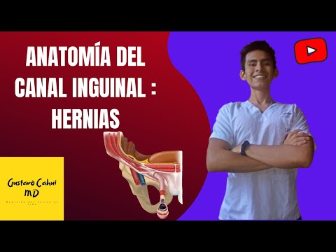 Vídeo: Diferencia Entre Hernia Inguinal Directa E Indirecta