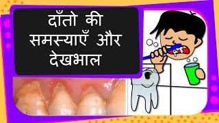 Science - How to take care of teeth, teeth problem and solutions - Hindi