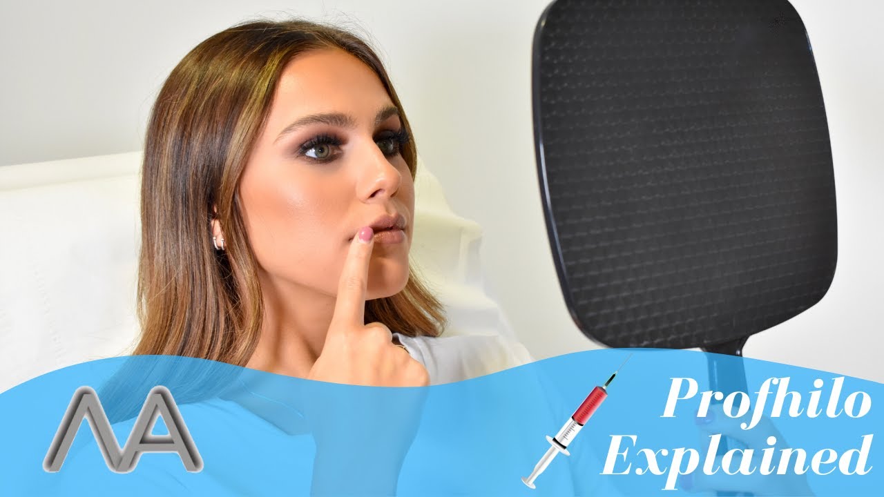 Profhilo Treatment Explained