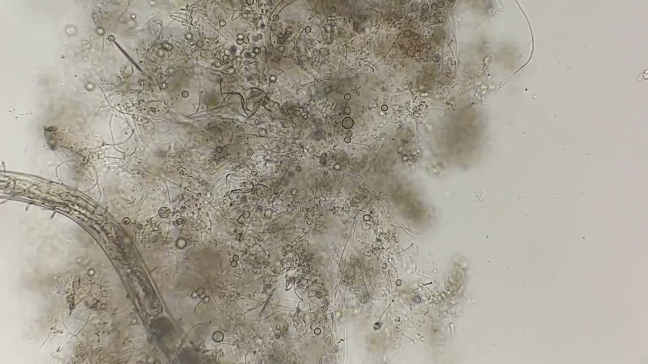 Free living worms - Nematoda