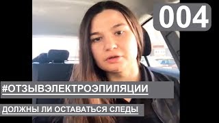 Отзывы Эпиляция - Электроэпиляция | Отзыв удаление волос навсегда. Без следов на теле Отзывы Эпиляция - Электроэпиляция | Отзыв удаление волос навсегда. Без следов на теле