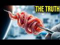 The Truth About Acupuncture Needles |The Micro Trauma Myth