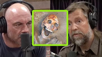 Blame Modern Diets, Not Genetics, for Your Crooked Teeth and Breathing Problems