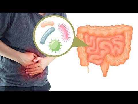 9 Signs You Have An Unhealthy Gut