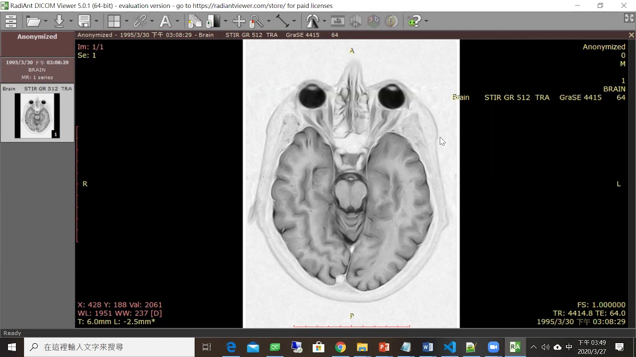 Dicom Window Level Window Width