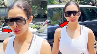 Malaika Arora Flaunts Her New BIG LIPS Outside Gym by Bollywood Infocus 239 views 2 days ago 1 minute, 31 seconds