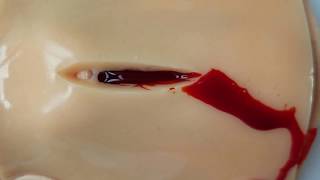 Cricothyrotomy Trainer Bleeding Your Design Medical 2 (Failed Airway Algorithm)