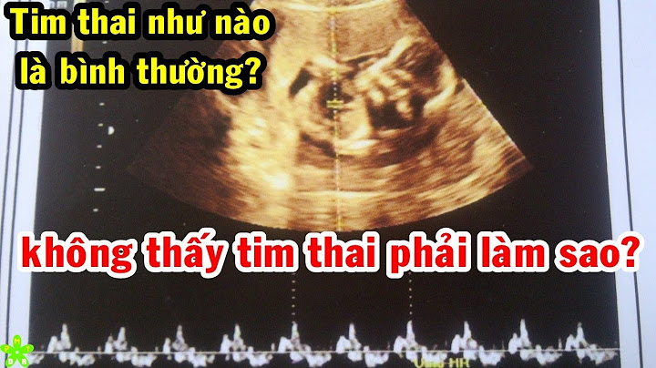 Tim thai nhi đập bao nhiêu là bình thường năm 2024