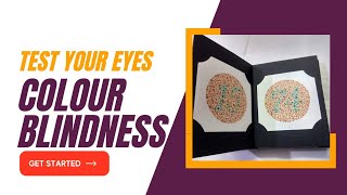 Ishihara Colour Vision Test | Colour Blindness Test | Test your eyes for Colour Vision