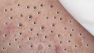 Download Lagu Satisfying Relaxing with Sac Dep Spa Video (#183) MP3 Download Lagu Satisfying Relaxing with Sac Dep Spa Video (#183) MP3