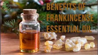 15 Amazing Benefits And Uses Of Frankincense Essential Oil | Organic Facts