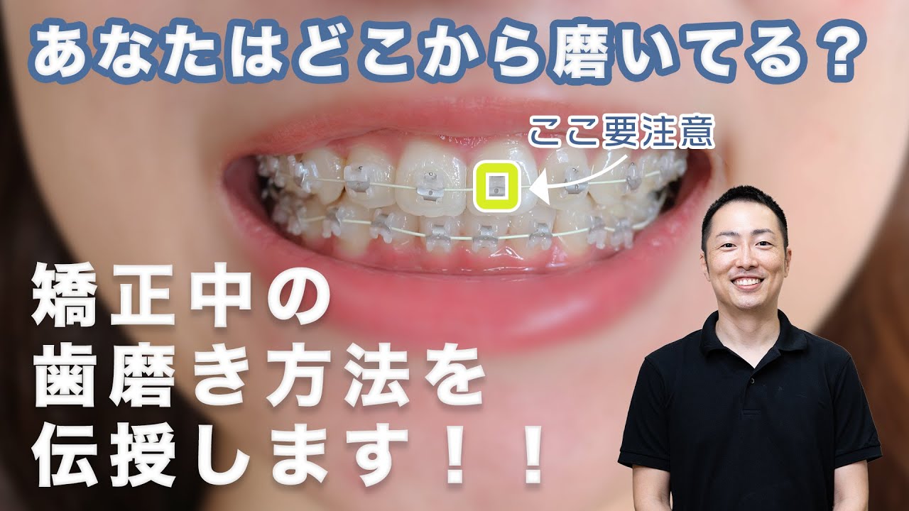 【矯正中の】あなたはどこから磨いてますか？【正しい歯磨き方法】