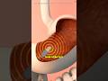 Capsule Endoscopy (3D Animation)#capsule #endoscopy #capsules #endoscopyprocedure #foryoupage