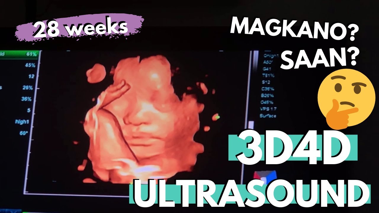 KELAN PWEDE MALAMAN ANG GENDER NG BABY? KELAN PWEDE MAGPA ULTRASOUND