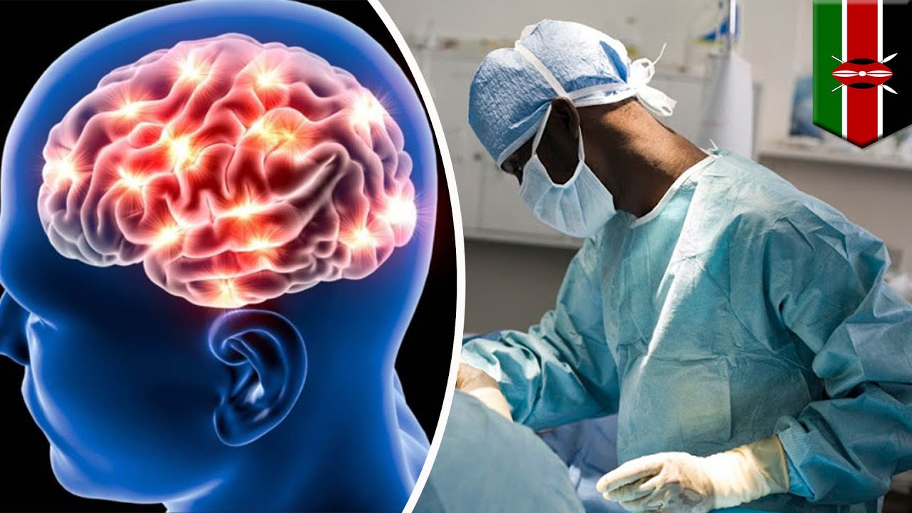 Surgery gone wrong: Brain surgeon operates on wrong patient . doh - TomoNew...