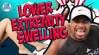 NPTE Practice Questions: Lower Extremity Swelling