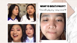 Bell's Palsy: My Friend's Bell's Palsy Story + Makeup Tutorial  (Philippines)