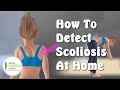 How to Detect Scoliosis at Home   |   Explained Under 1 minute