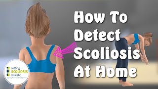 How to Detect Scoliosis at Home   |   Explained Under 1 minute Resimi
