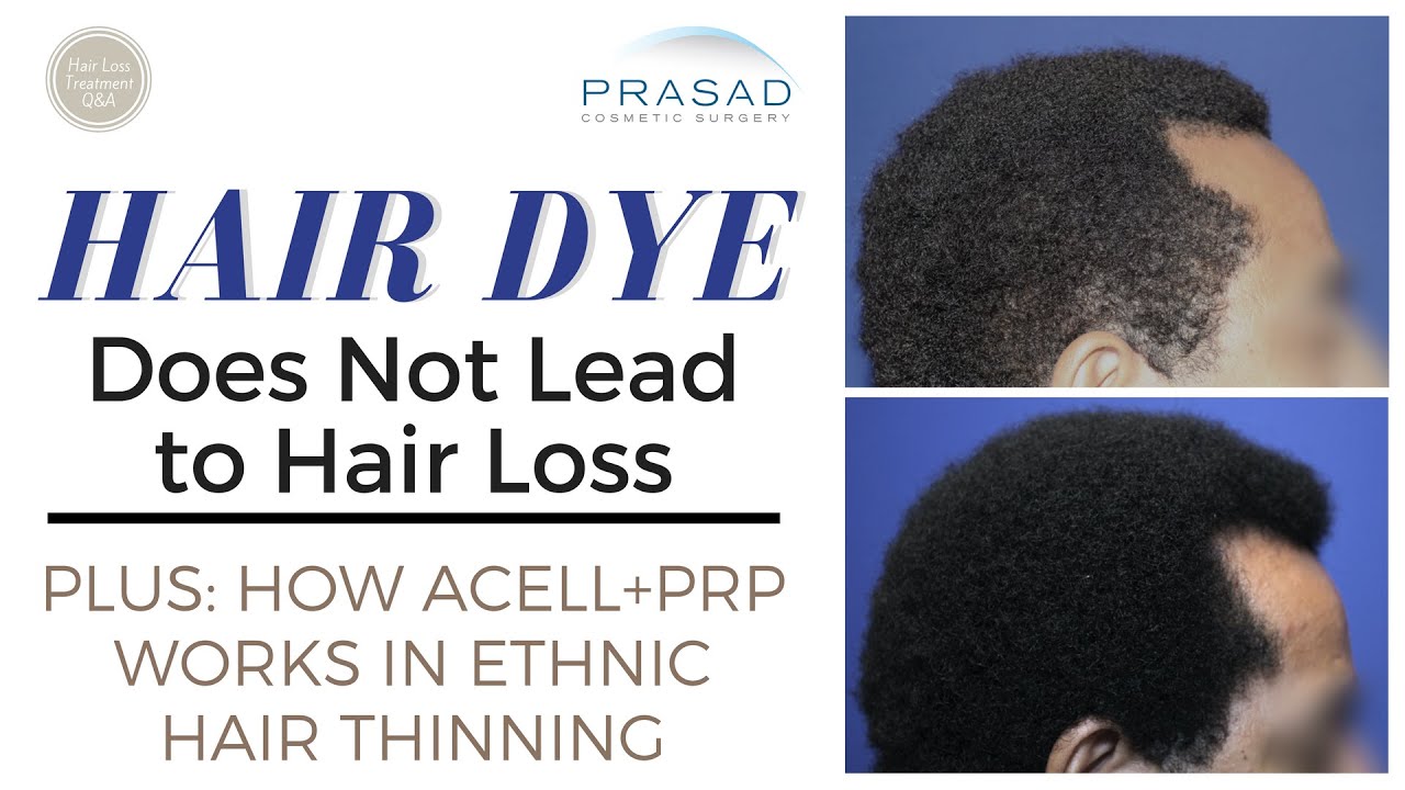 Why Hair Dyes Dont Cause Hair Thinning And Treating African