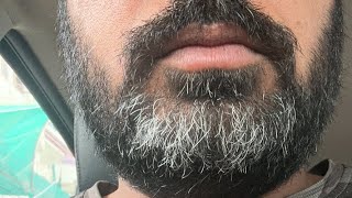 ਕੁਝ ਨੀ ਟੈਟਲ