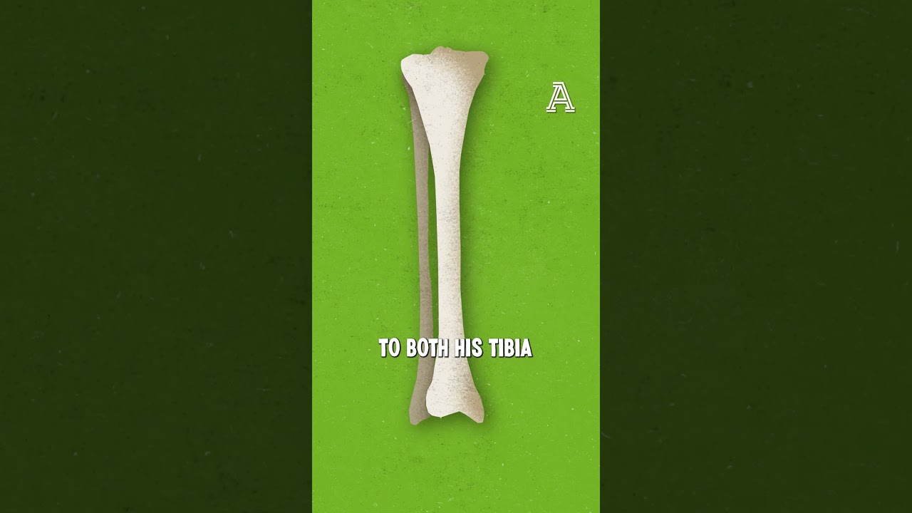 What was the worst injury in Premier League history?