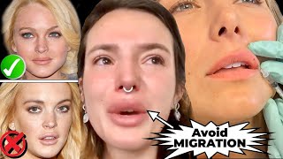 BEFORE YOU GET LIP FILLERS- WATCH THIS- How to Avoid MIGRATION & BOTCHED LIPS screenshot 3
