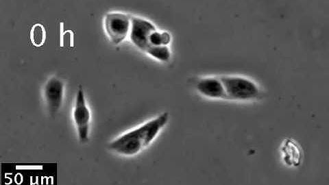 Cell Migration towards a Gradient