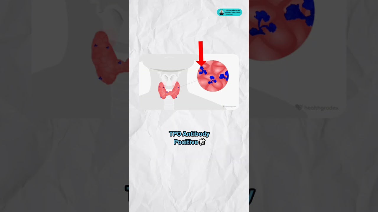 Borderline Thyroid Deficiency: Exploring the Impact and Solutions. 