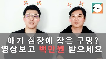 애기 심장에 작은 구멍이 있다면? 영상보시고 백만원 받으세요