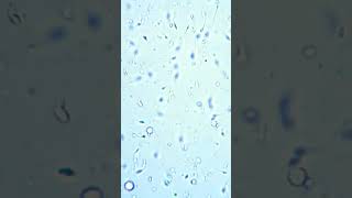 How sperm looks under a microscope #shorts
#shorts
slivkivideos@gmail.com
Instagram - https://www.instagram.com/slivki_kuki/
music: epidemicsound.com How sperm looks under a microscope #shorts