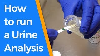 How to run a Urine Analysis