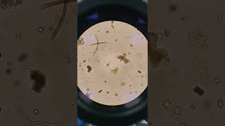 #microscopic examination of stool