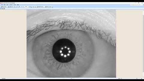 IRIS recognition Using CNN on Casia dataset |  +91-9872993883 for query | Total class 224