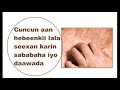 Cuncunka Aan Habeenkii Lala Seexani Karin Sababaha Iyo Daawada Dr Mohamud Aden Cuncunka Aan Habeenkii Lala Seexani Karin Sababaha Iyo Daawada Dr Mohamud Aden