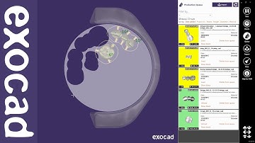 exocad Video Tutorial (basic): exocam