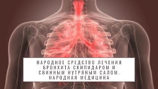 ★Народное средство лечения бронхита скипидаром и свинным нутряным салом. Народная медицина