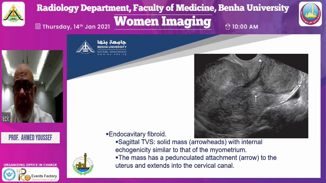 Ultrasound in infertility