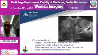 Ultrasound in infertility