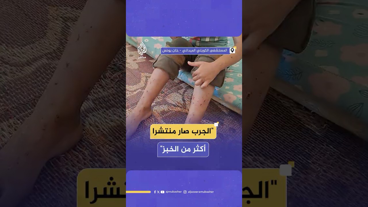 الأمراض الجلدية تفتك بأهل غزة في ظل التدهور البيئي والصحي وعدم توافر الأدوية