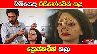 මිනිසෙකු රයිනෝවෙක් කළ ප්‍රොස්තටික් කලා