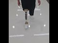 넓적다리의지 대퇴의족 실인타입 실리콘 다이니온 보행