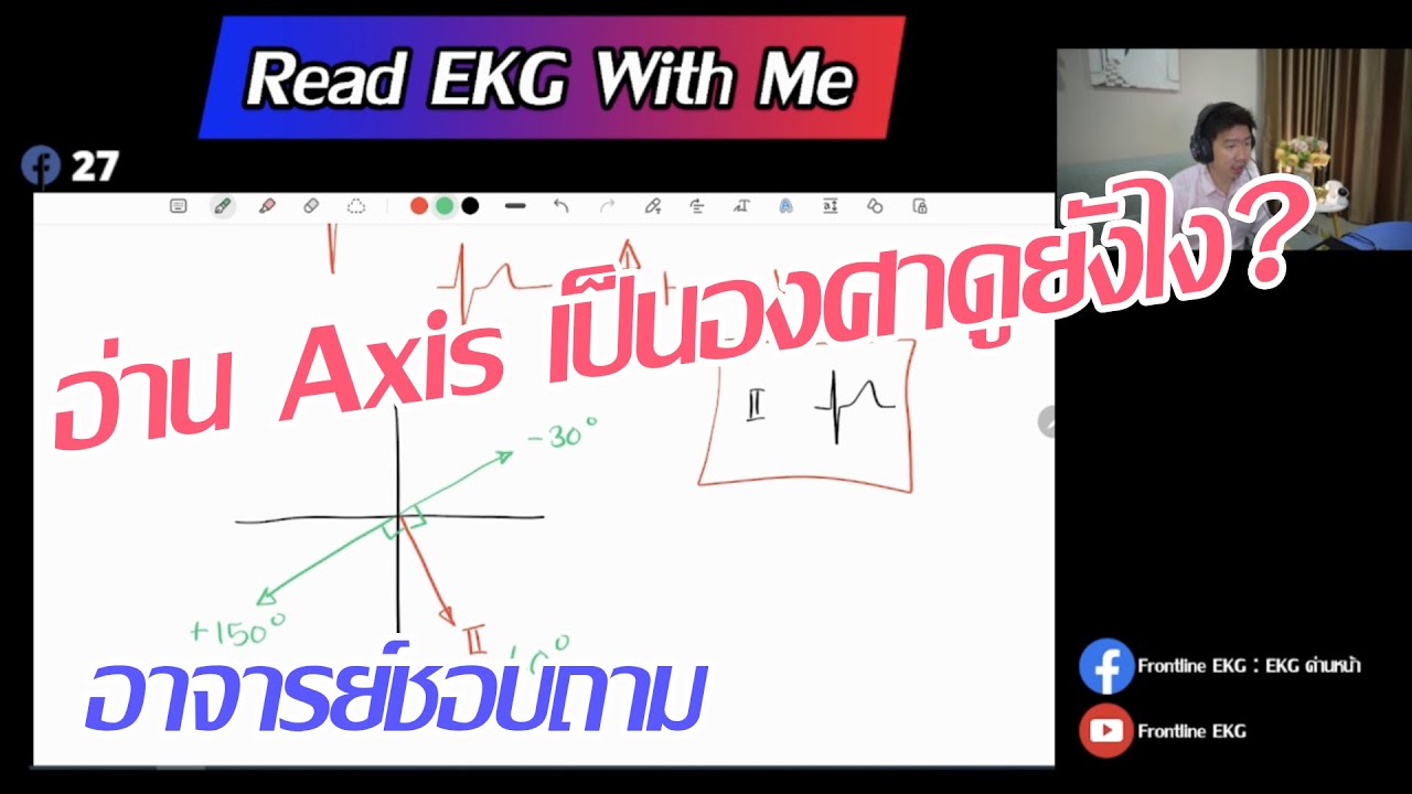 อ่าน Axis เป็นองศา ดูยังไง? | EKG Reading Tips | Frontline EKG
