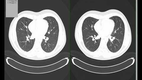 Infomedica HTML5 DICOM viewer Mac Safari