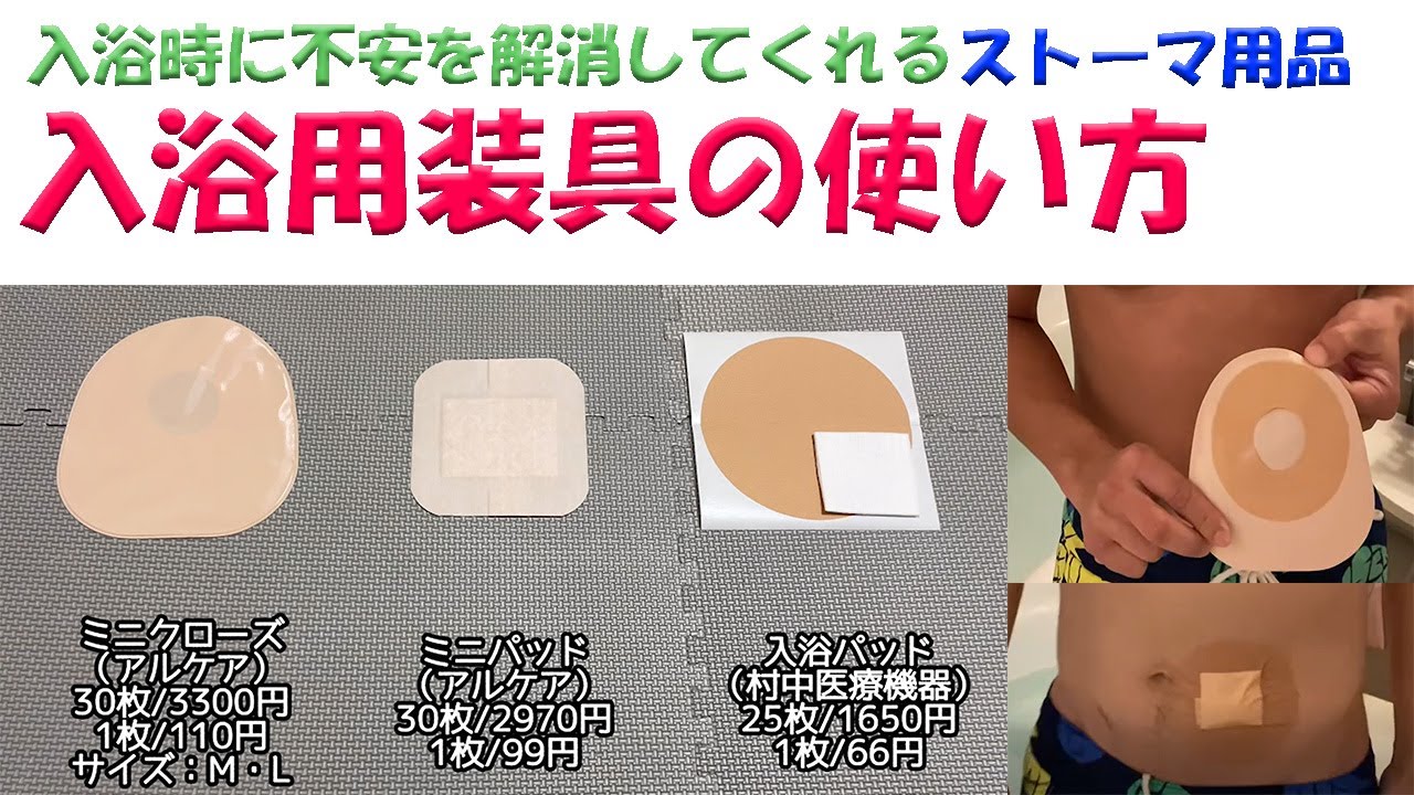 動画】入浴時に不安を解消してくれるストーマ用品・入浴用装具の使い方 