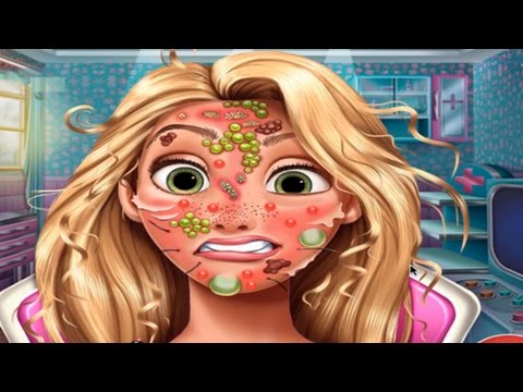 Juegos friv 2016 |Rapunzel Skyn Doctor - YouTube