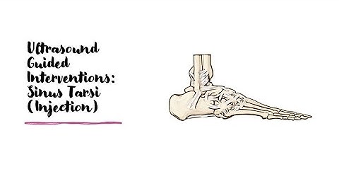 Sinus Tarsi Injection Explained | Non-Surgical Treatment for Ankle Pain