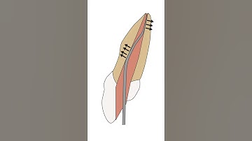 Animated video showing how the SafeSiders clean the canal walls