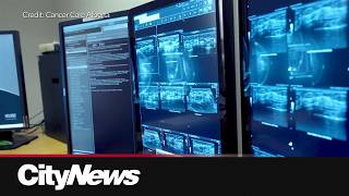 Alberta plans future of cancer care