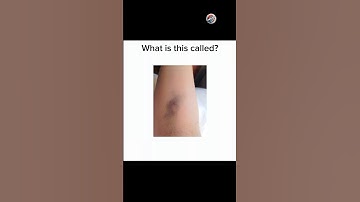 English quiz challenge part 978 #newquiz